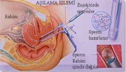 asilama_yontemi